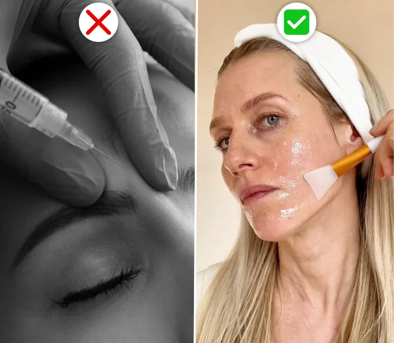 8. BONUS : l'effetto tensore, senza aghi